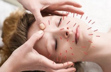 Myofascial Trigger Points Vancouver | Body Option Clinic