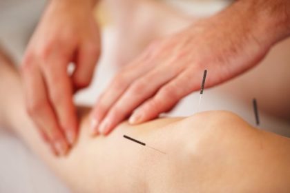 Acupuncturist Vancouver: How to Choose One | Body Option Clinic
