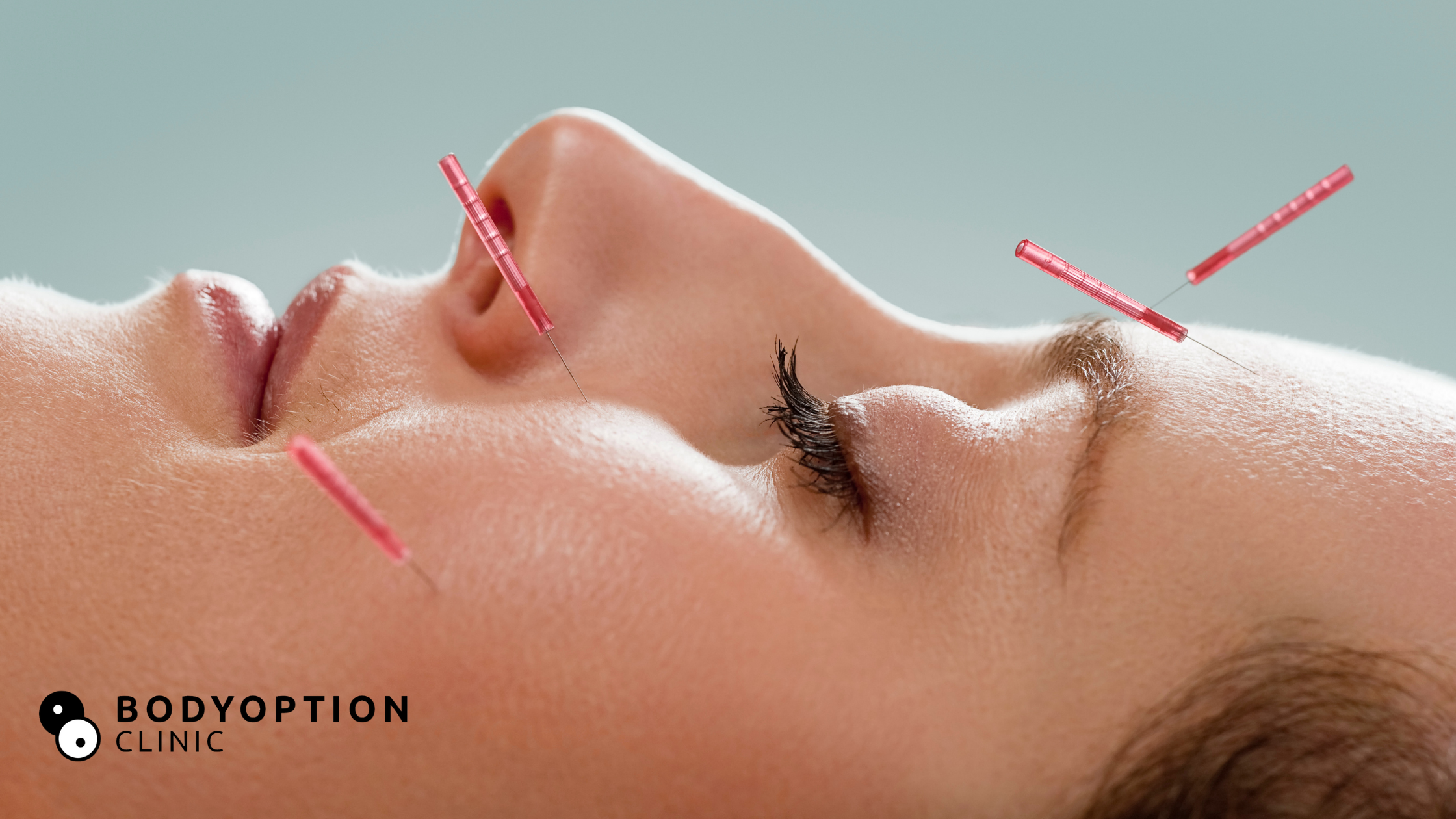 Facial Acupuncture: What Is It and Is It Safe?